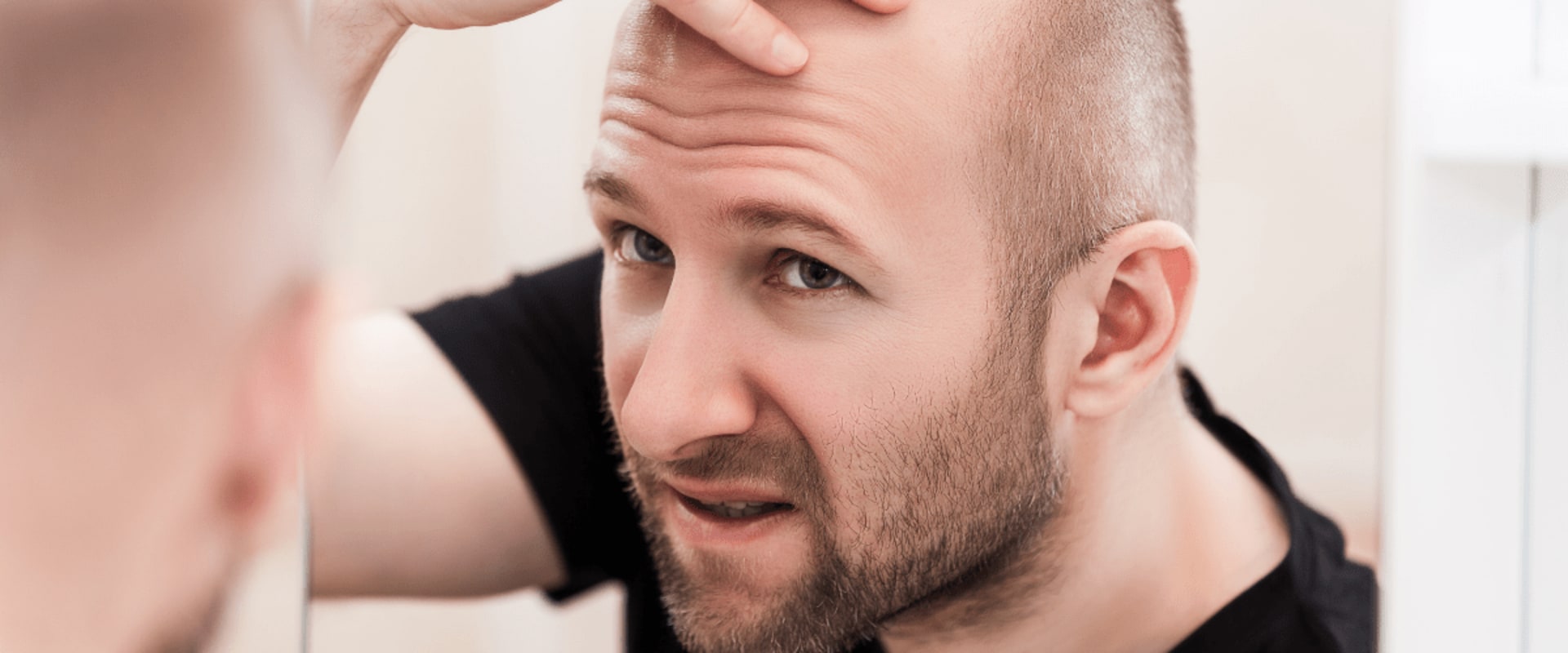 Understanding Hereditary Hair Loss: Causes and Genetics