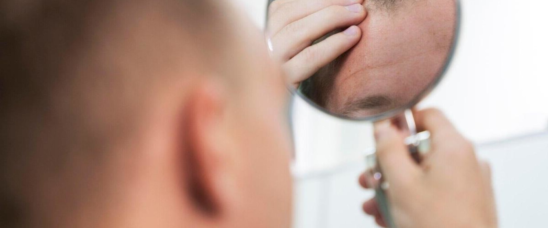 A Comprehensive Look at Hair Transplants