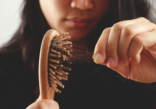 Natural Remedies for Female Hair Loss