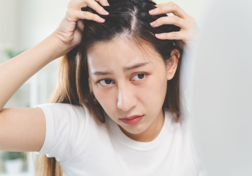 Scalp Treatments for Hair Growth: A Comprehensive Guide