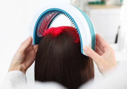 Understanding Low-level Laser Therapy (LLLT) for Hair Loss Treatment